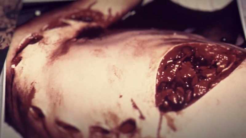 VALERIE: We heard about Rodney's shark attack with horror