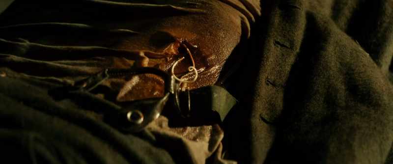 Wait, Doc, Doc, Doc. Doc, look. His stomach