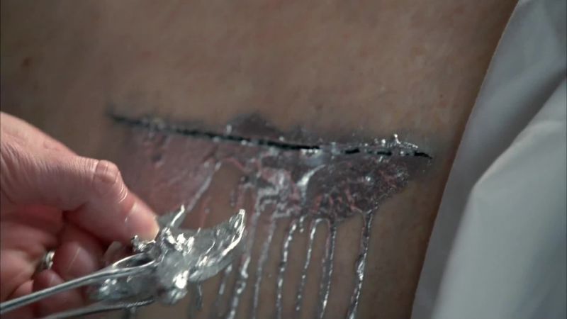 Walter: It was in his spine. I was right