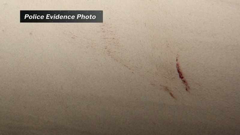 We were able to note that there was some cast-off blood