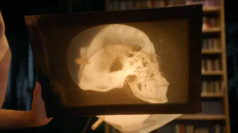 We could get this Röntgen film from the physicians