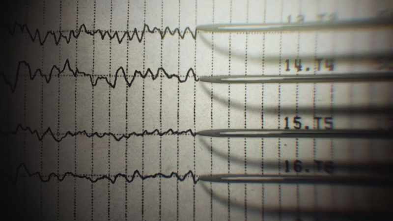 We did not find any gross neurological problems