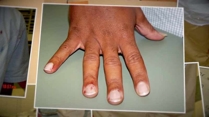 We extracted gunshot residue from both hands