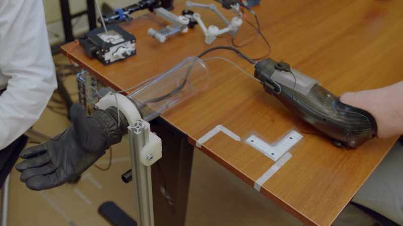 We have separated out the prosthetic arm