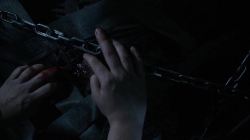 We have to stop the bleeding and get the bullet out