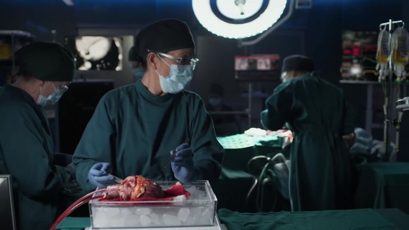 We need 2.6-millimeter-thick tissue with perfect compliance