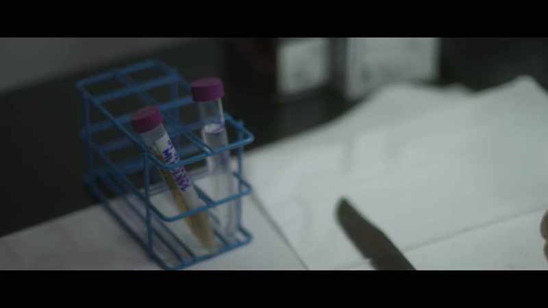 We test for 24 different areas on the DNA molecule