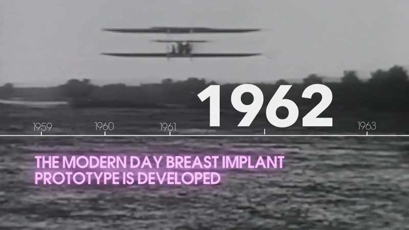 We weren't the first to try to augment the breast