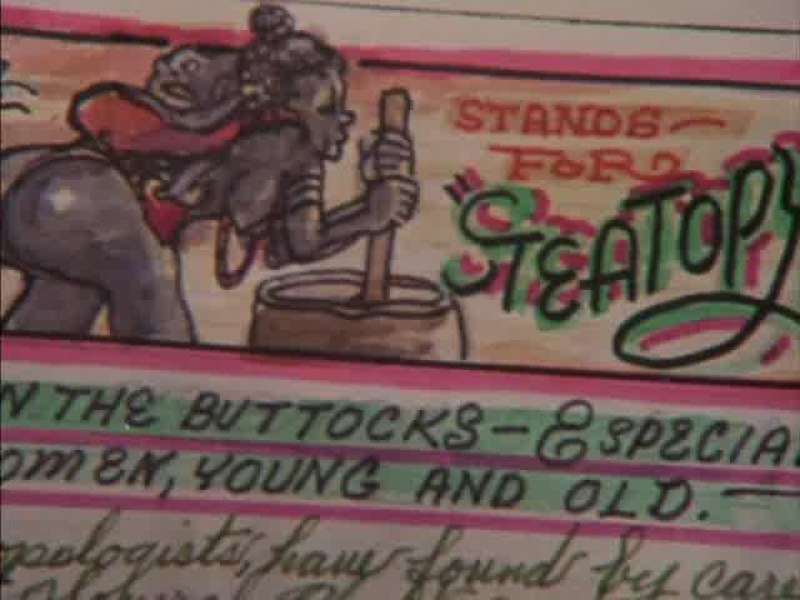 Well anyway that's what we call steatopygic