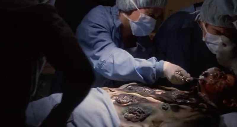 We'll cut him right here. Gauze