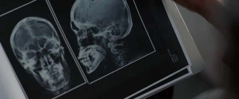 Well, your head seems to have healed nicely