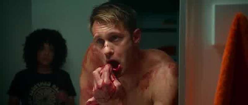 Well you should see the other guy