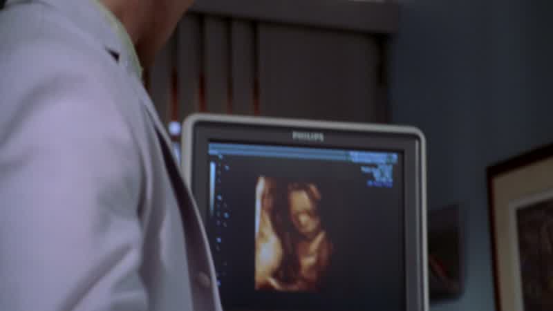 Well, ultrasound looks good