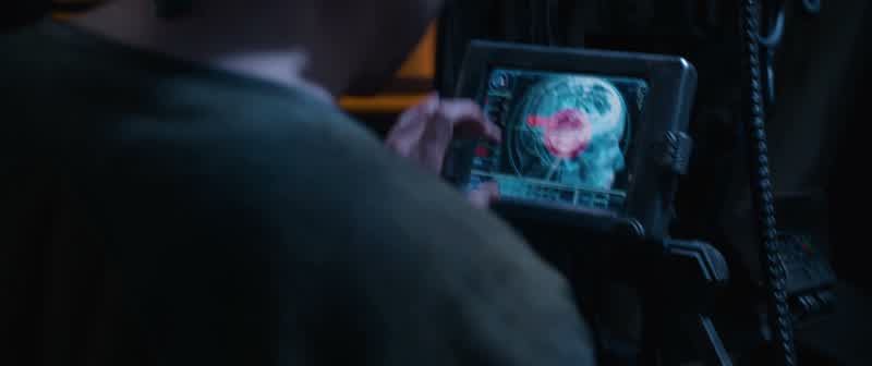 We're losing him