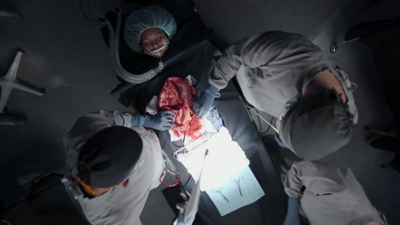 We've cleared the omentum covering