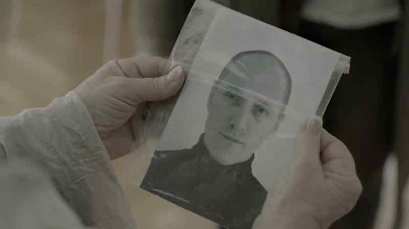 What did he have done? -Hairline, nose, mouth, teeth