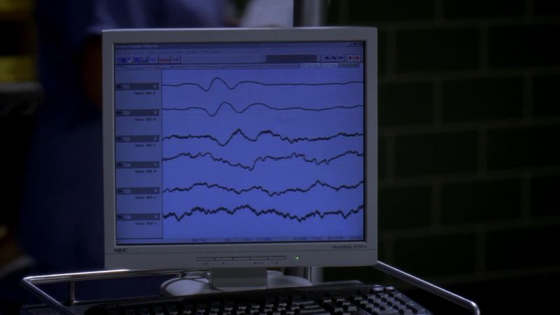 What, did you... you paralyze him?