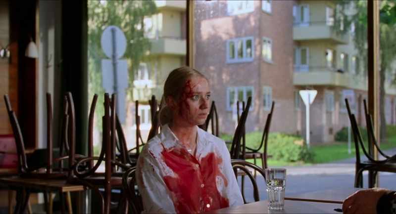 What happened? - I got bit