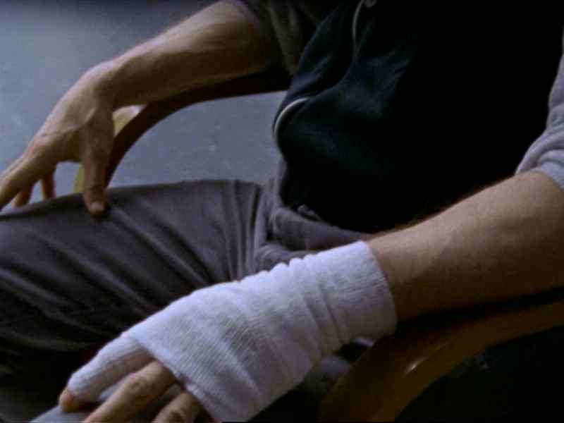What happened to your hand?