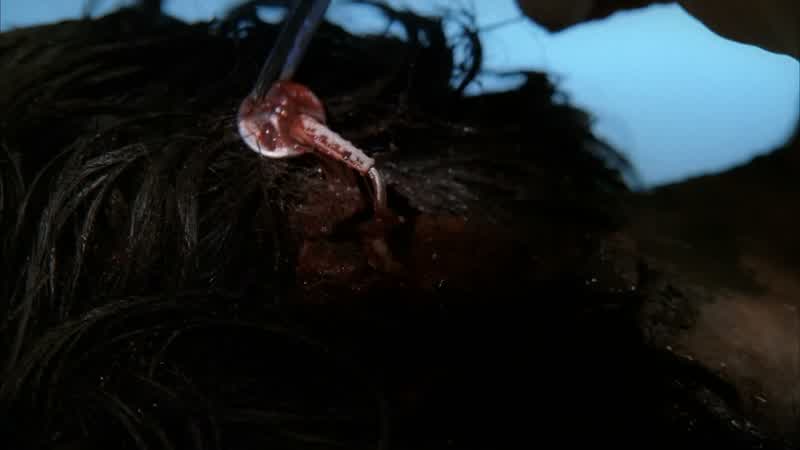 What is that?