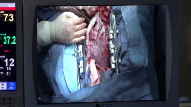 What is it? - Her rhythm is deteriorating