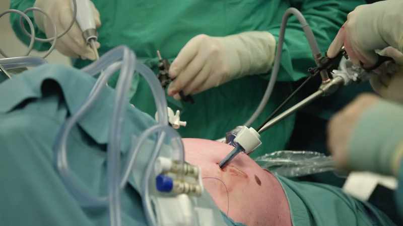 What is that? -Abdominal surgery