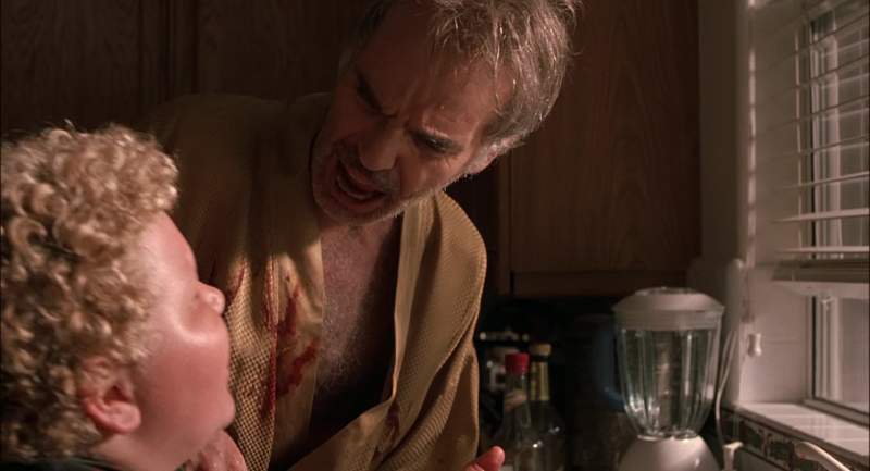 What the hell happened to you I cut my hand by mistake