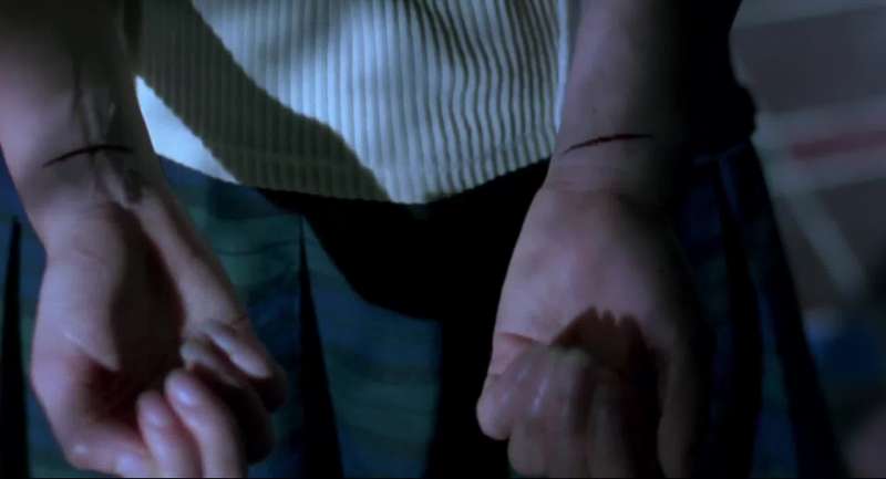 What's wrong with your scars Sarah