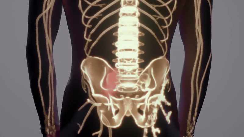 When a nerve is injured, instead of going dark