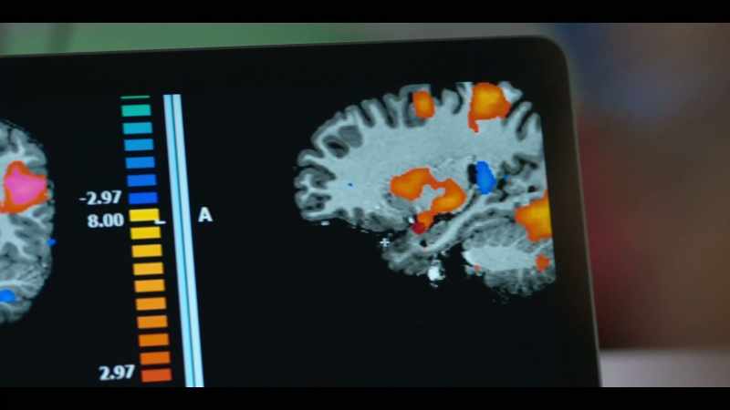 When we look at dad's brain, we saw quite a different story
