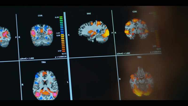 When we looked at mom's brain