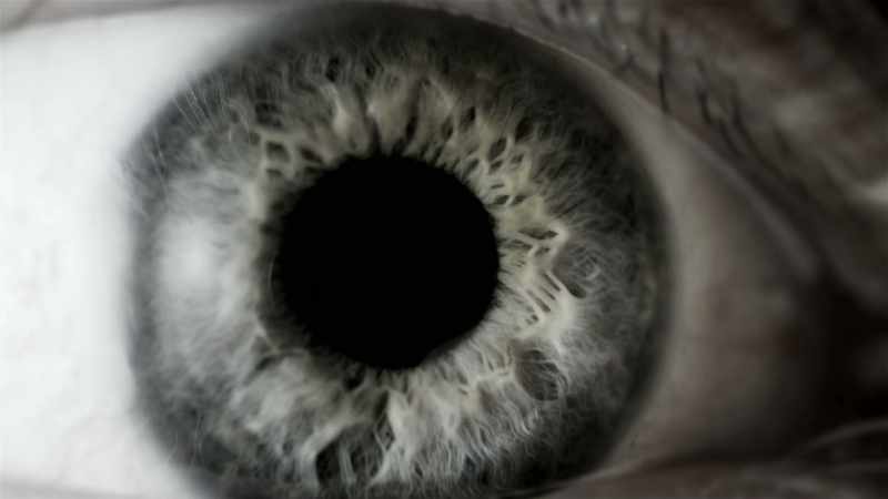 WHEN THE EYE IS DILATED, THERE'S A REFLECTIVE AREA