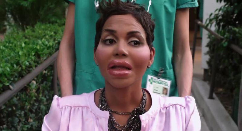 When the swelling goes down, you're going to look great, Emily