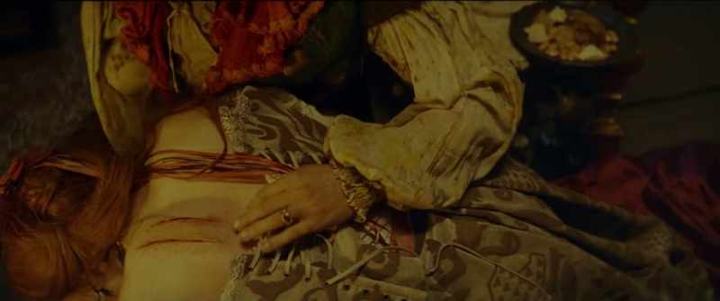 Who did this to you? - They flogged me