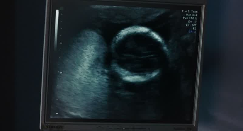 Whoa Check out Baby Big HeadDude that thing is freaky lookingExcuse me I am a sacred vesselall right All you've got in your stomach is Taco Bell