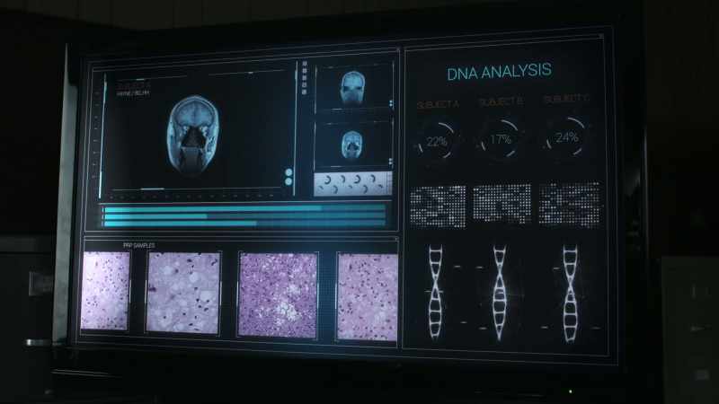 Why do some exposed to the prion transform and others do not?