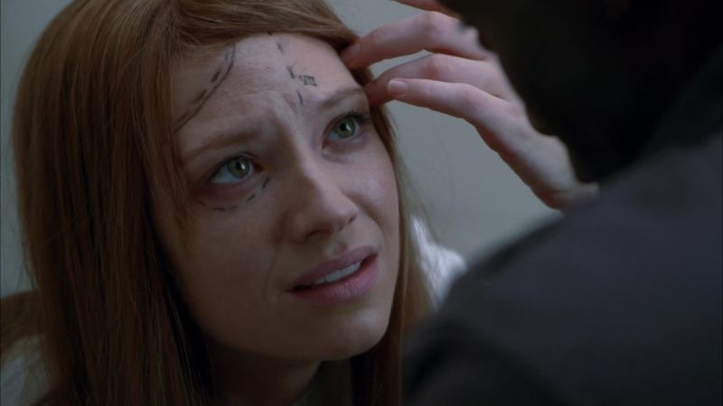 Why I have these marks on my forehead?