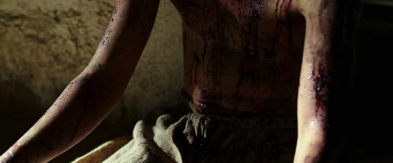 [winces]