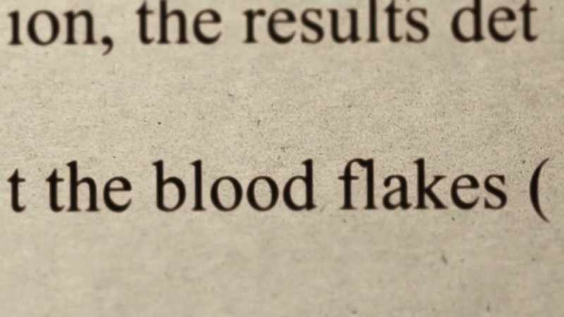 With blunt force trauma
