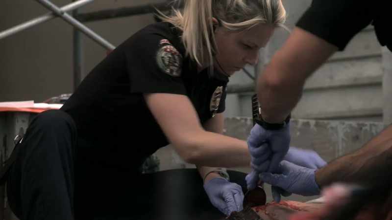 Yeah, there are two bleeders, both the internal and the external iliac. They're both leaking