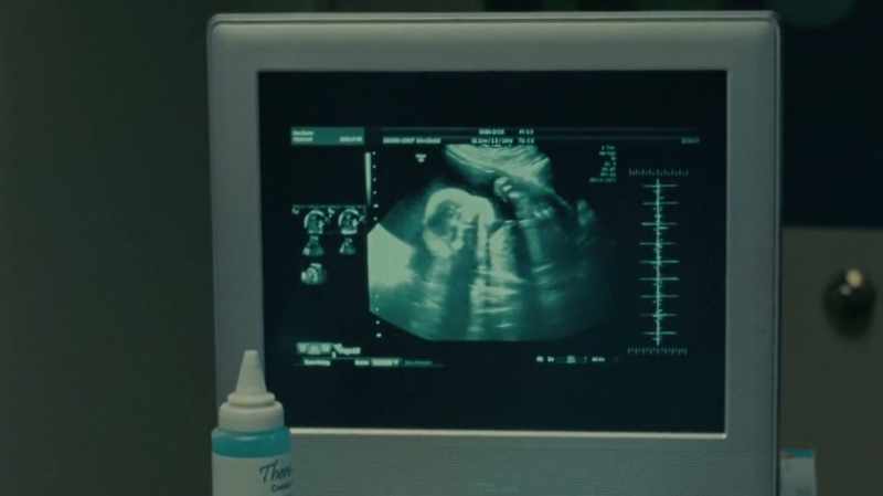 You are about ten weeks along