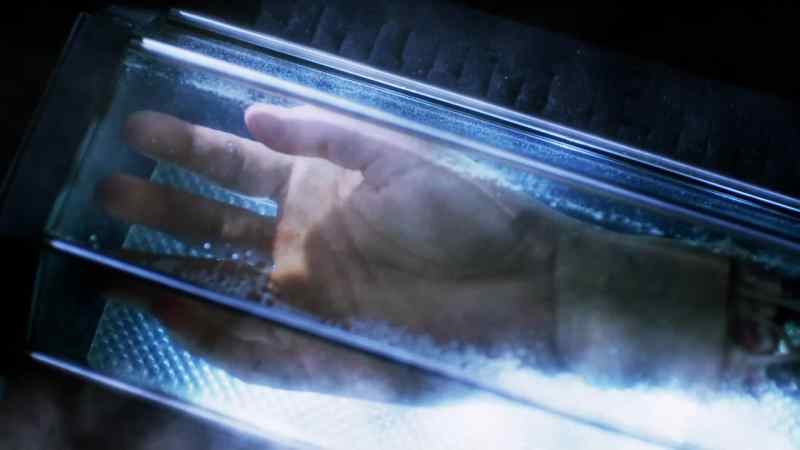 You are looking at a bio-prosthesis