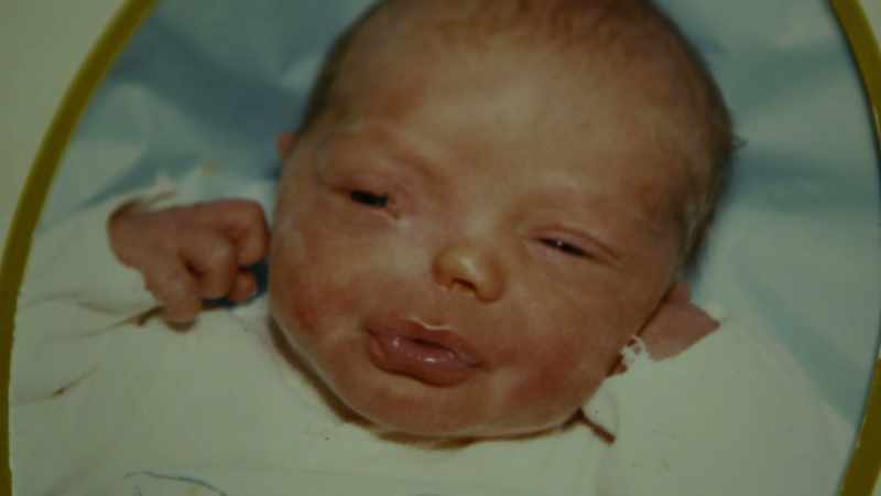 You could argue that Bucky Bailey's birth defects were not related
