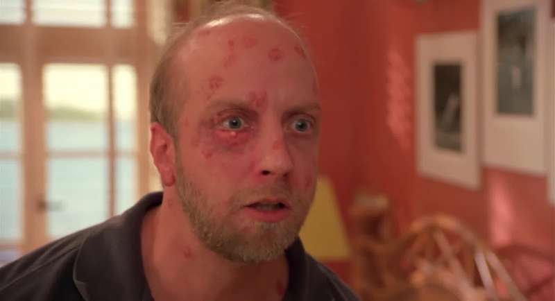 Groans Geez You ever had a whitehead on your eyeball Mary Hmm