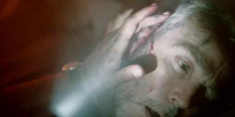 You have a skull fracture on the same side as a blown pupil