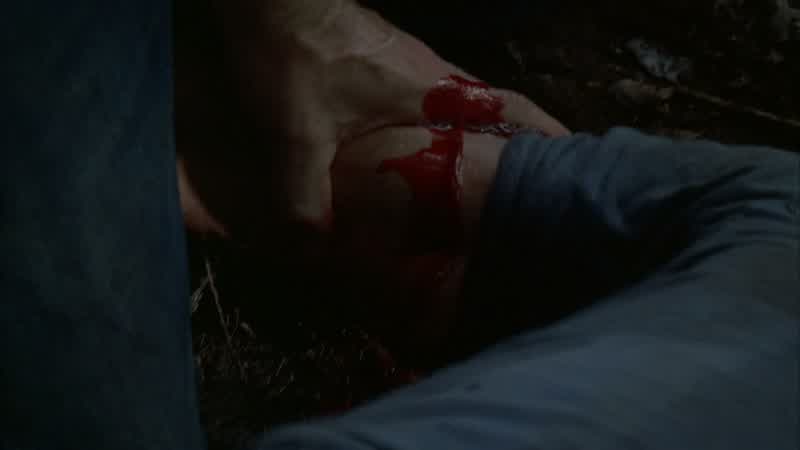 You hit an artery