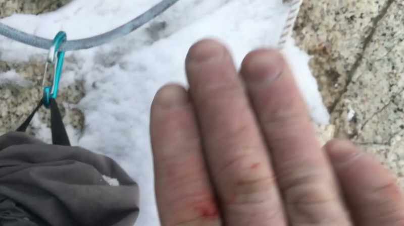 You know, my fingers were bleedin'