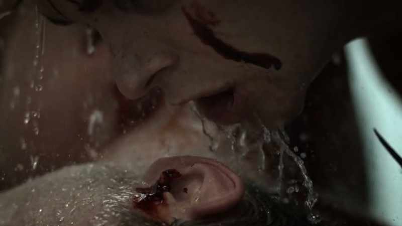 You should have kept your bloody mouth shut