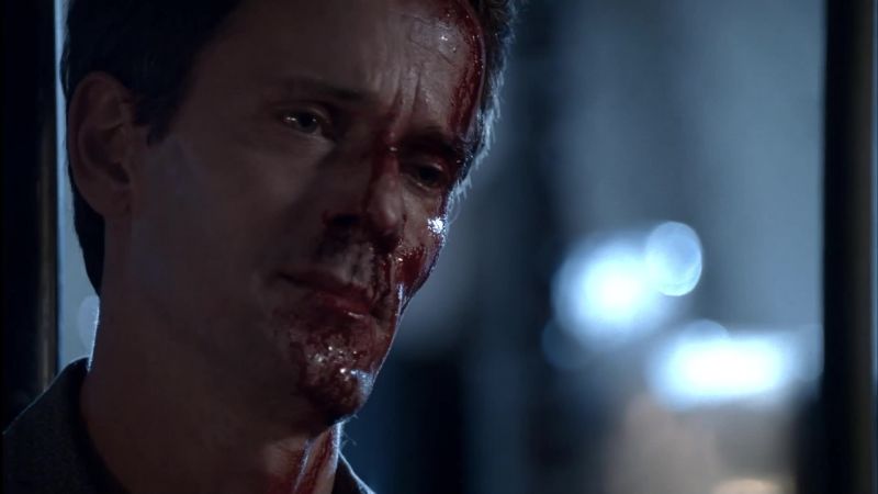 You think you know about pain?
