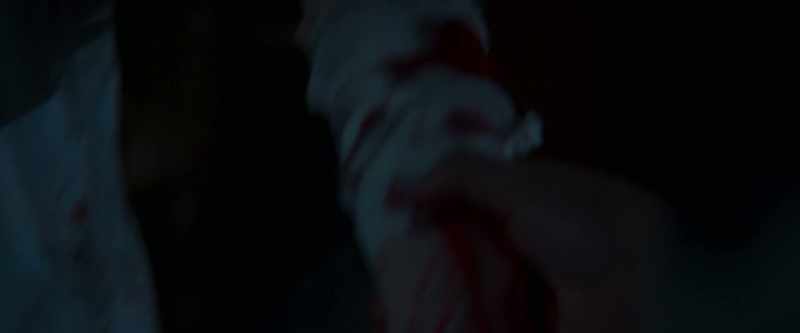 Your arm's bleeding. Come here
